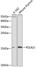 Anti-POLR2J antibody used in Western Blot (WB). GTX54570