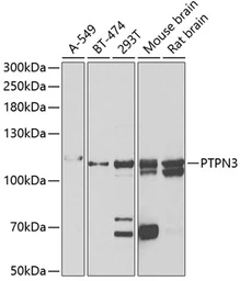 Anti-PTPN3 antibody used in Western Blot (WB). GTX54572