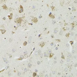 Anti-PTPN3 antibody used in IHC (Paraffin sections) (IHC-P). GTX54572
