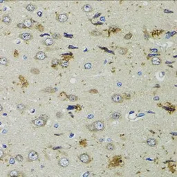 Anti-PTPN3 antibody used in IHC (Paraffin sections) (IHC-P). GTX54572