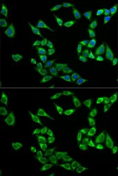 Anti-TSSC3 antibody used in Immunocytochemistry/ Immunofluorescence (ICC/IF). GTX54573