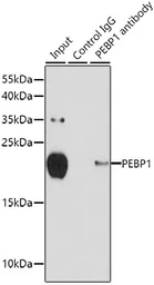 Anti-RKIP antibody used in Immunoprecipitation (IP). GTX54574