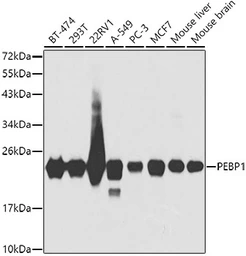 Anti-RKIP antibody used in Western Blot (WB). GTX54574