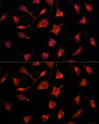 Anti-RKIP antibody used in Immunocytochemistry/ Immunofluorescence (ICC/IF). GTX54574