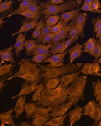 Anti-RKIP antibody used in Immunocytochemistry/ Immunofluorescence (ICC/IF). GTX54574