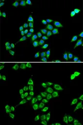 Anti-Pyruvate Carboxylase antibody used in Immunocytochemistry/ Immunofluorescence (ICC/IF). GTX54577