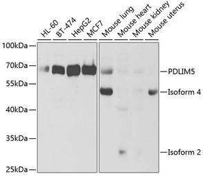 Anti-PDLIM5 antibody used in Western Blot (WB). GTX54578