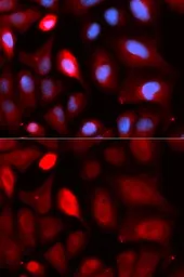 Anti-PDLIM5 antibody used in Immunocytochemistry/ Immunofluorescence (ICC/IF). GTX54578