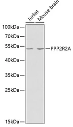 Anti-PPP2R2A antibody used in Western Blot (WB). GTX54580