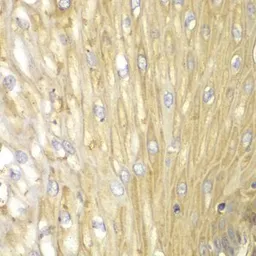 Anti-PPP2R2A antibody used in IHC (Paraffin sections) (IHC-P). GTX54580