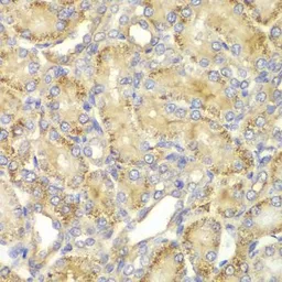 Anti-PPP2R2A antibody used in IHC (Paraffin sections) (IHC-P). GTX54580