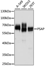 Anti-PSAP antibody used in Western Blot (WB). GTX54581