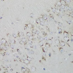 Anti-PSAP antibody used in IHC (Paraffin sections) (IHC-P). GTX54581