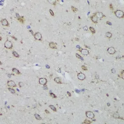 Anti-PSAP antibody used in IHC (Paraffin sections) (IHC-P). GTX54581