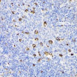 Anti-PSAP antibody used in IHC (Paraffin sections) (IHC-P). GTX54581