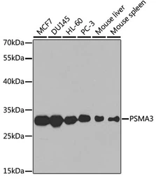 Anti-PSMA3 antibody used in Western Blot (WB). GTX54582