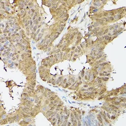 Anti-PSMA3 antibody used in Immunocytochemistry/ Immunofluorescence (ICC/IF). GTX54582