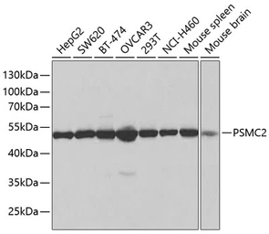 Anti-PSMC2 antibody used in Western Blot (WB). GTX54583