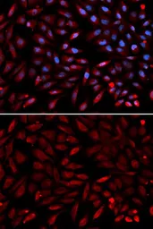 Anti-PSMC2 antibody used in Immunocytochemistry/ Immunofluorescence (ICC/IF). GTX54583