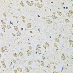 Anti-PSMC2 antibody used in IHC (Paraffin sections) (IHC-P). GTX54583