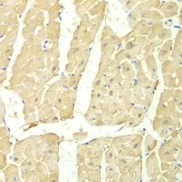 Anti-PSMC2 antibody used in IHC (Paraffin sections) (IHC-P). GTX54583