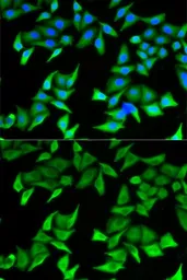Anti-Nectin 2 antibody used in Immunocytochemistry/ Immunofluorescence (ICC/IF). GTX54584