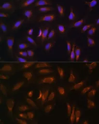 Anti-NRBF2 antibody used in Immunocytochemistry/ Immunofluorescence (ICC/IF). GTX54585