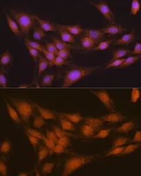 Anti-NRBF2 antibody used in Immunocytochemistry/ Immunofluorescence (ICC/IF). GTX54585