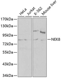 Anti-NEK8 antibody used in Western Blot (WB). GTX54586