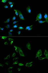 Anti-NEK8 antibody used in Immunocytochemistry/ Immunofluorescence (ICC/IF). GTX54586