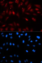 Anti-EBP1 antibody used in Immunocytochemistry/ Immunofluorescence (ICC/IF). GTX54589