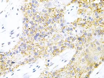 Anti-PPP2R4 antibody used in IHC (Paraffin sections) (IHC-P). GTX54592