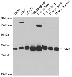 Anti-PSME1 antibody used in Western Blot (WB). GTX54593