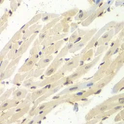 Anti-PSME1 antibody used in IHC (Paraffin sections) (IHC-P). GTX54593