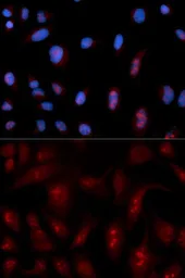 Anti-PLCB1 antibody used in Immunocytochemistry/ Immunofluorescence (ICC/IF). GTX54594