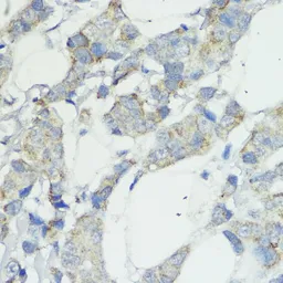 Anti-NOD1 antibody used in IHC (Paraffin sections) (IHC-P). GTX54595