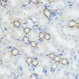 Anti-NOD1 antibody used in IHC (Paraffin sections) (IHC-P). GTX54595