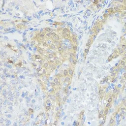 Anti-NOD1 antibody used in IHC (Paraffin sections) (IHC-P). GTX54595