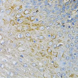 Anti-NPC2 antibody used in IHC (Paraffin sections) (IHC-P). GTX54597