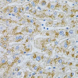 Anti-NPC2 antibody used in IHC (Paraffin sections) (IHC-P). GTX54597