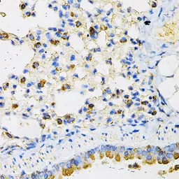 Anti-NPC2 antibody used in IHC (Paraffin sections) (IHC-P). GTX54597