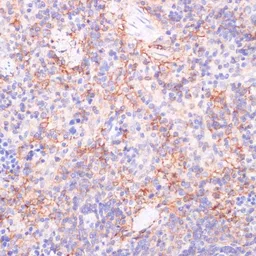 Anti-CD73 antibody used in IHC (Paraffin sections) (IHC-P). GTX54599