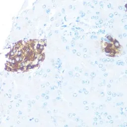 Anti-ODC antibody used in IHC (Paraffin sections) (IHC-P). GTX54600
