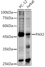 Anti-PAX2 antibody used in Western Blot (WB). GTX54602