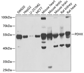 Anti-PDHX antibody used in Western Blot (WB). GTX54603