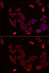 Anti-PDHX antibody used in Immunocytochemistry/ Immunofluorescence (ICC/IF). GTX54603