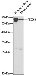 Anti-PDZK1 antibody used in Western Blot (WB). GTX54604