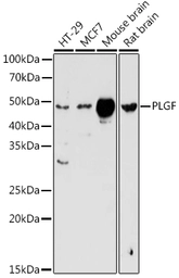 Anti-PLGF antibody used in Western Blot (WB). GTX54606