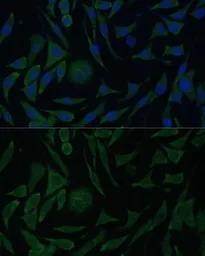 Anti-PGRMC1 antibody used in Immunocytochemistry/ Immunofluorescence (ICC/IF). GTX54607