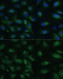Anti-PGRMC1 antibody used in Immunocytochemistry/ Immunofluorescence (ICC/IF). GTX54607